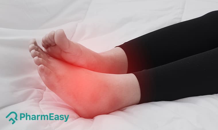 Swollen Legs: Natural Home Remedies for Relief in India