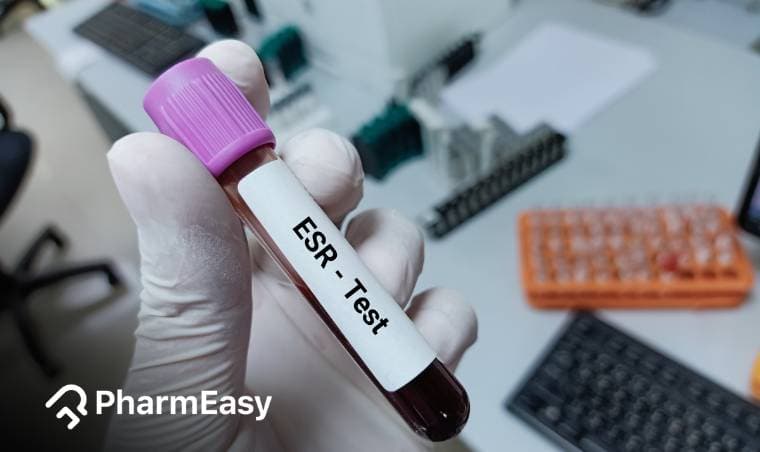 ईएसआर टेस्ट: क्या है, नॉर्मल रेंज, खर्च और प्रक्रिया
