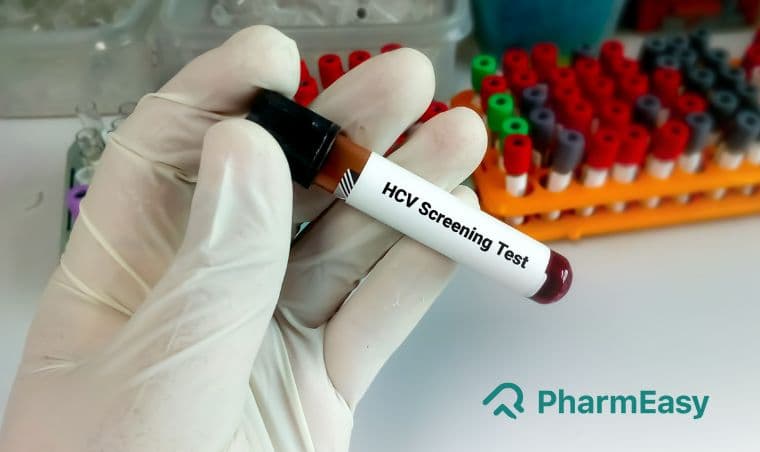 HCV टेस्ट: जानें क्या है, खर्च, नॉर्मल रेंज और कब कराएं