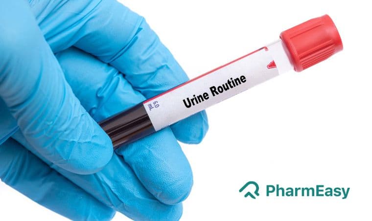 यूरिन रूटीन टेस्ट: खर्च, नॉर्मल रेंज, कैसे करें