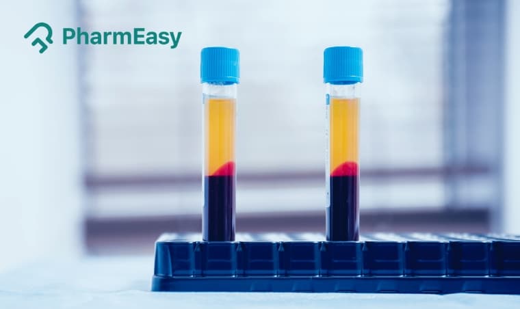 Normal Platelet Count: Understanding Low & High Levels