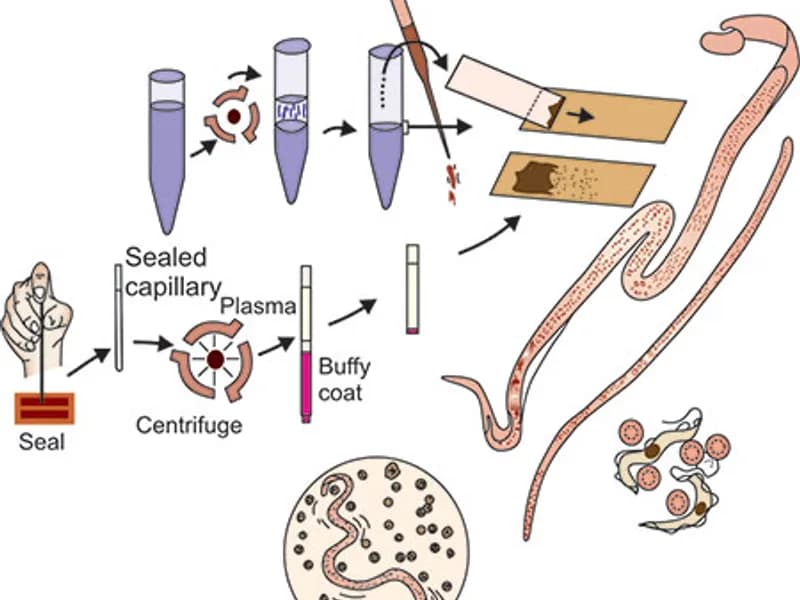 Wet Mount for Parasites: A Clearer Look at Your Health