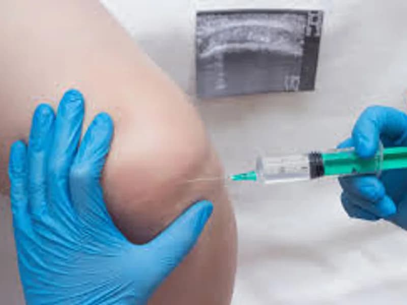 ADA Drain Fluid Test: A Vital Tool for Joint Health