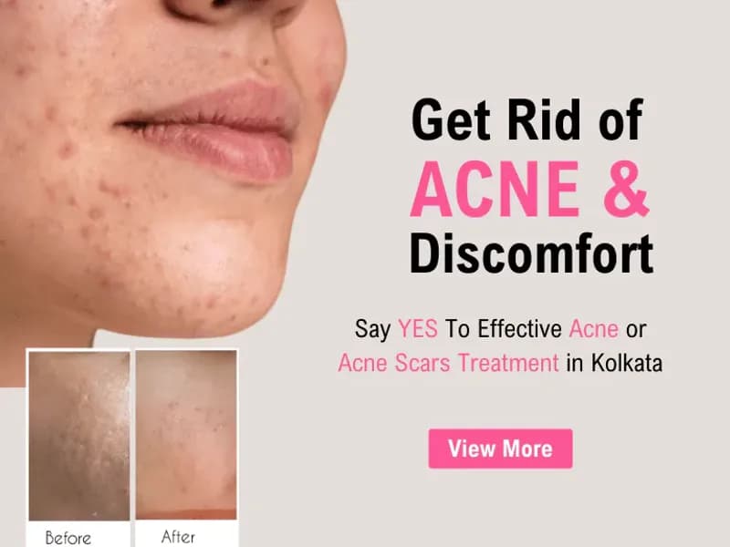 Top Dermatologist in Kolkata