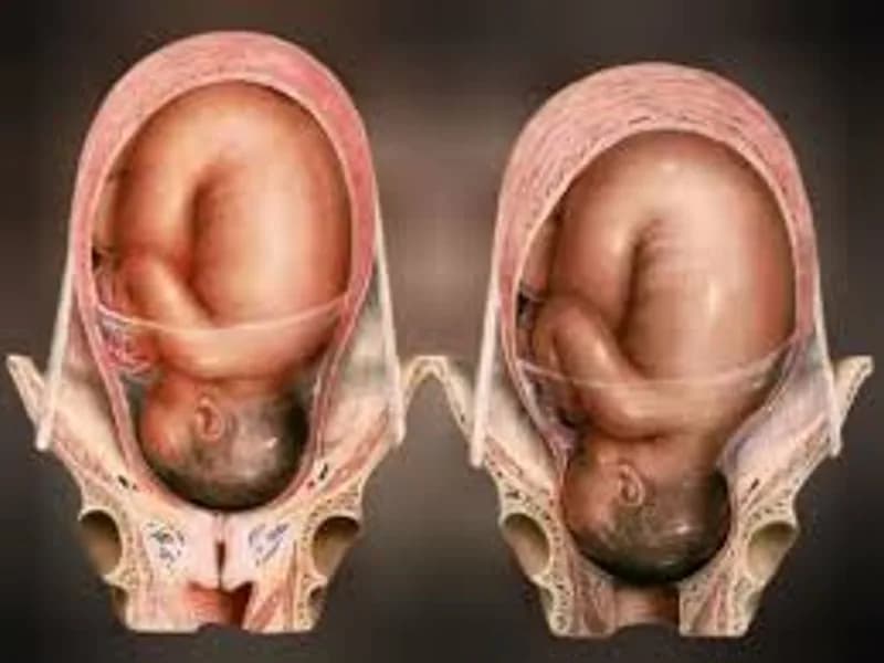 Baby Not Engaged at 9 Months Pregnancy: What to Know