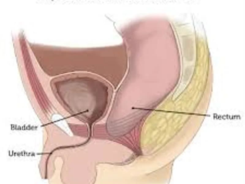 Child imperforate anus low anomaly perineal anoplasty in Deoghar