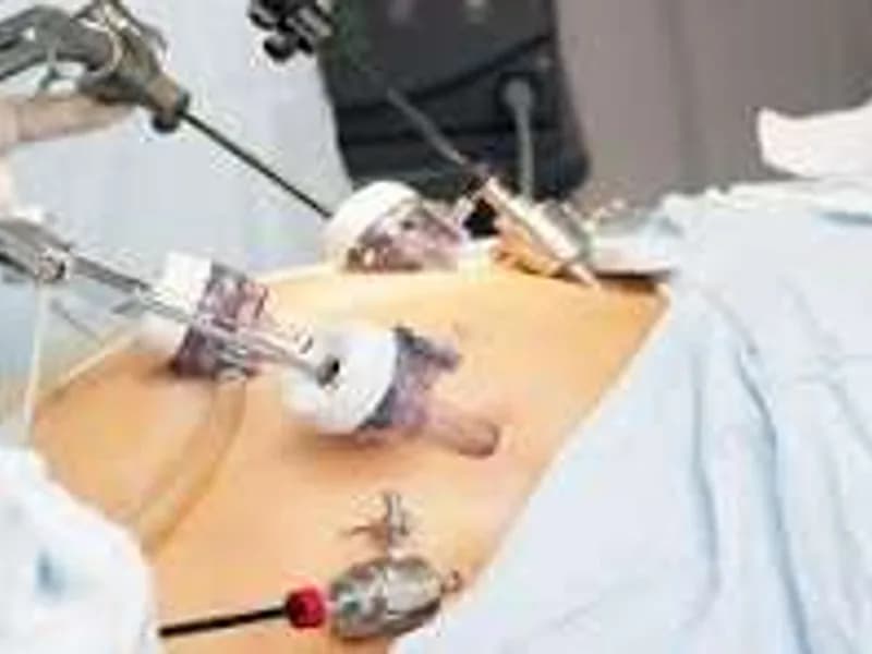 Female Laparoscopic Surgery in Ranchi