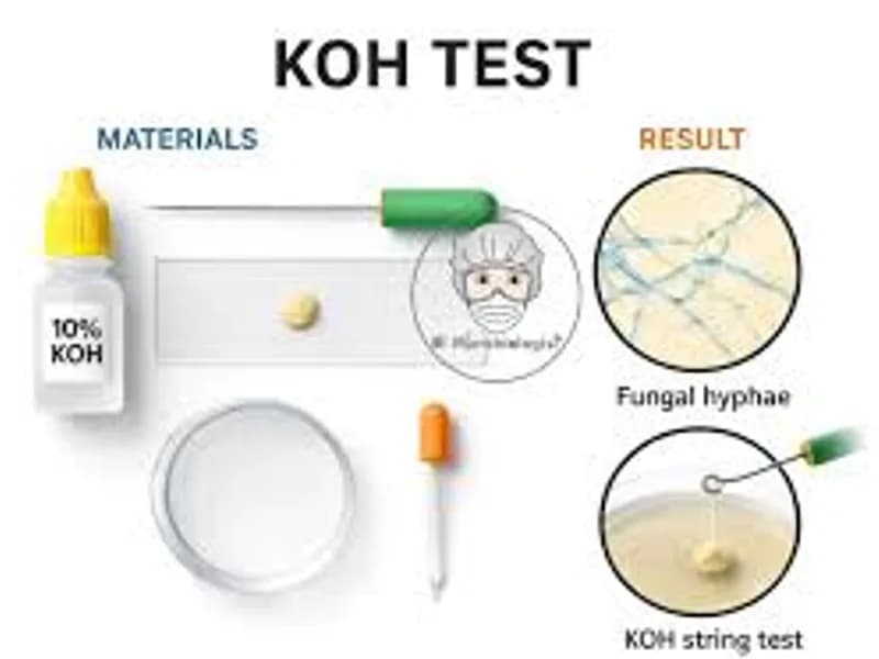 KOH Prep: A Quick Test for Fungal Infections