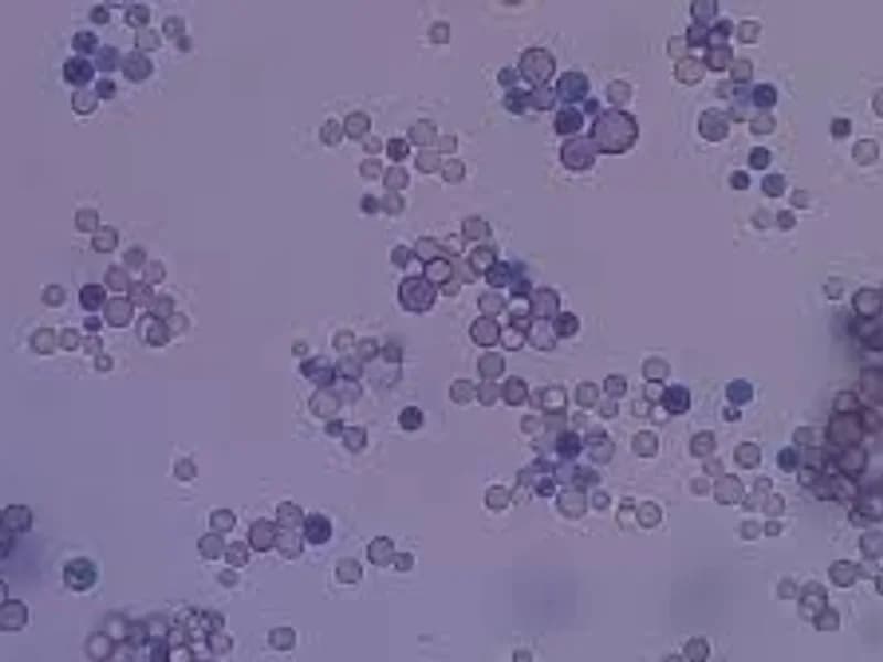 India Ink: A Vital Tool in Diagnosing Cryptococcus