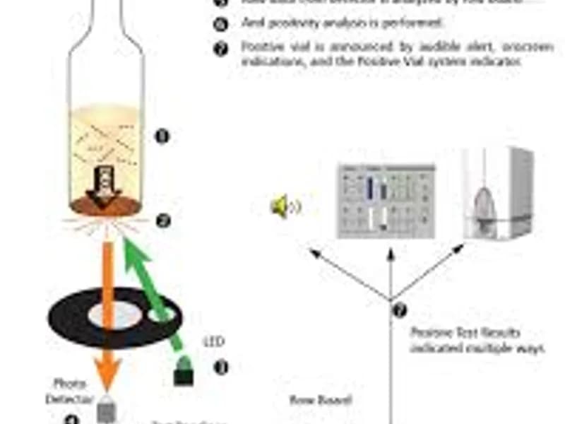Automated Fungus Blood Cultures: A Faster Path to Diagnosis