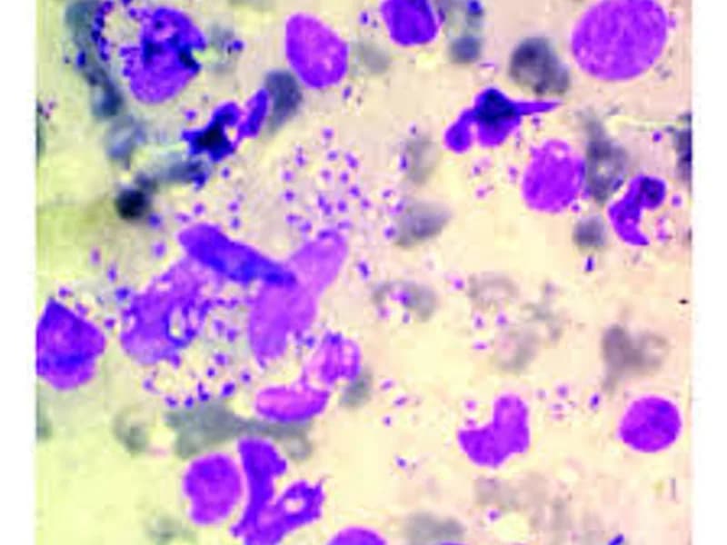 Unmasking Leishmaniasis: The Vital Role of Special Staining