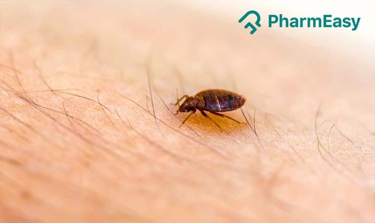 Bed Bug Bites: Causes, Symptoms, Treatment, Prevention & Relief