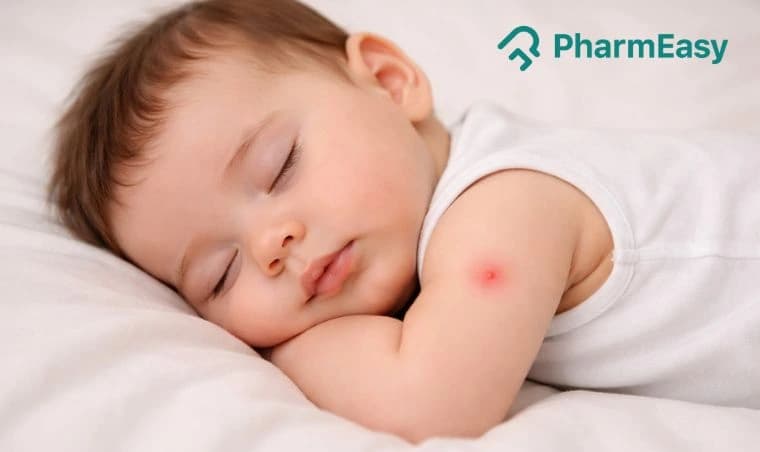 Baby Mosquito Bites: Relief, Remedies & Prevention in India