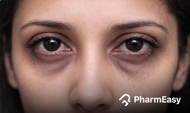 Sunken Eyes: Causes, Symptoms, Remedies & When to See a Doctor