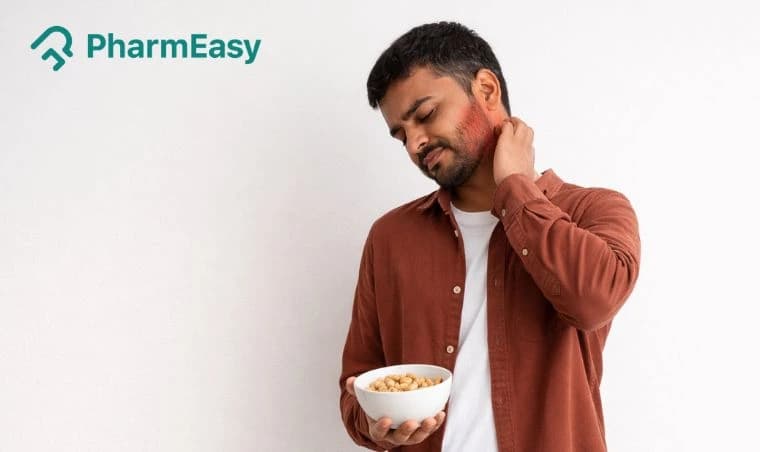 Food Allergies in India: Symptoms, Diagnosis, and Management