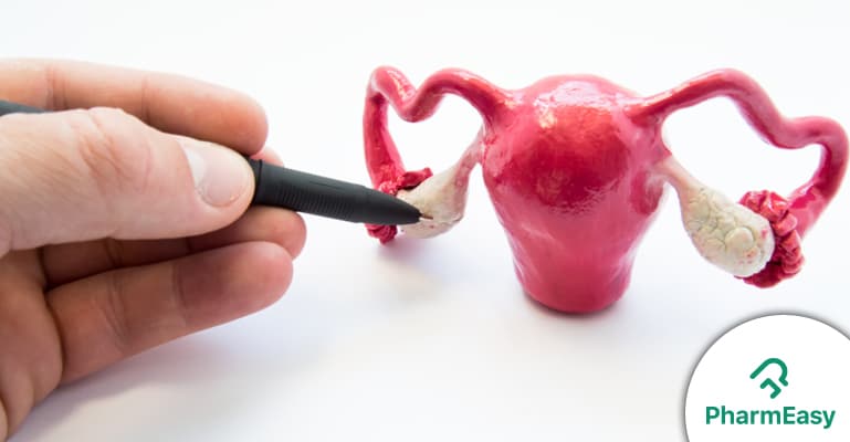 PCOD: Symptoms, Causes, and Treatment Options in India