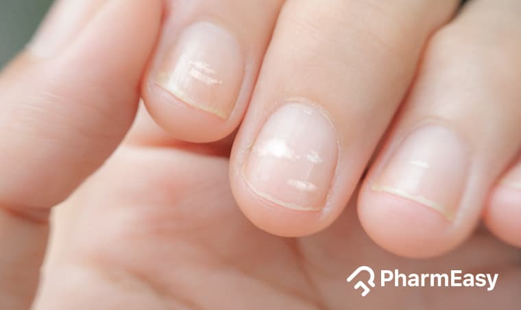 Zinc Deficiency Symptoms: Are You Getting Enough Zinc?