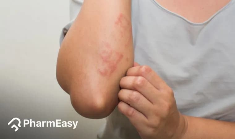 Red Spots on Skin: Causes, Symptoms, Treatment & When to Worry