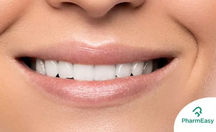 Natural Teeth Whitening: Home Remedies by Dr. Siddharth Gupta