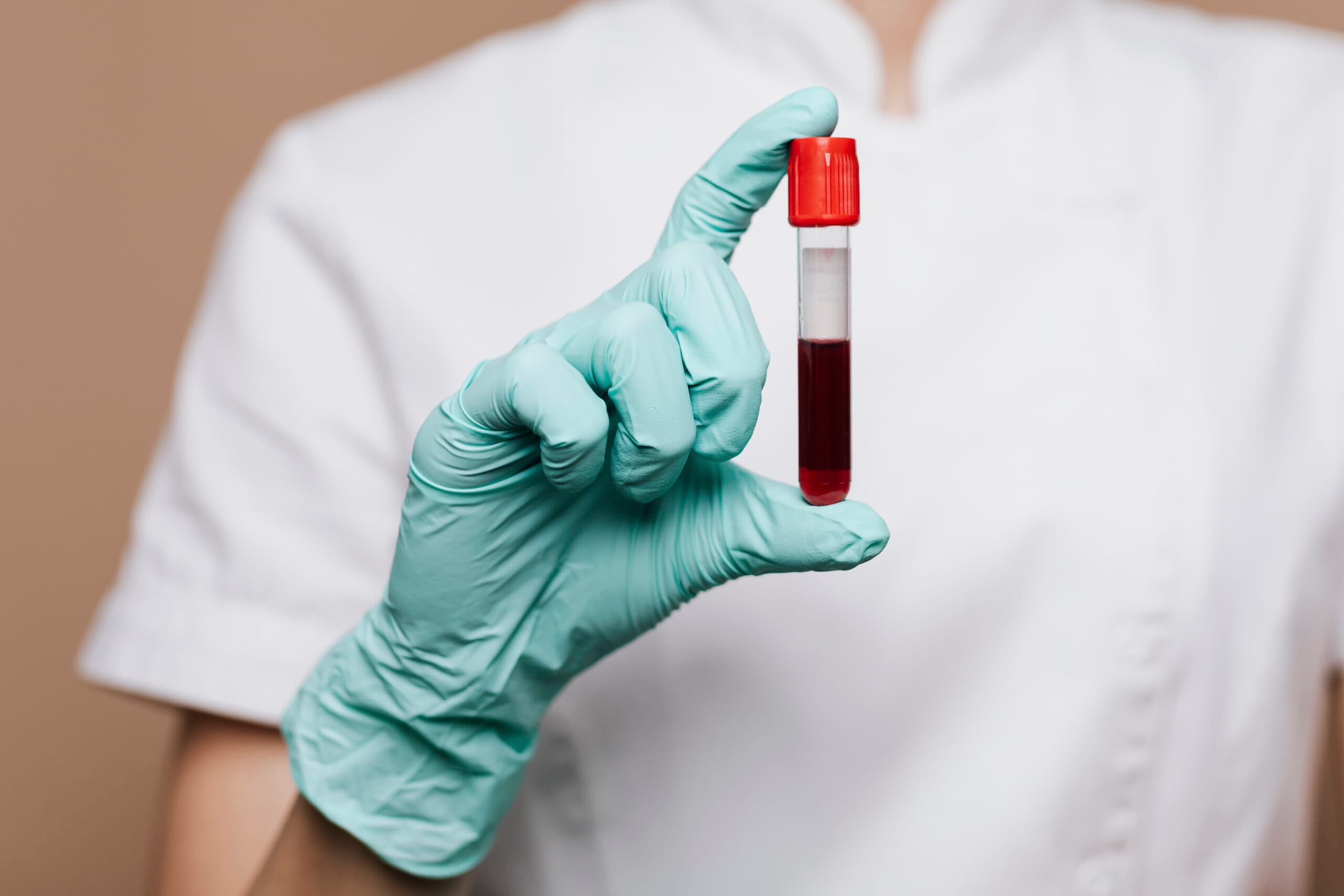 High ESR: What It Means and Why It Matters for Your Health