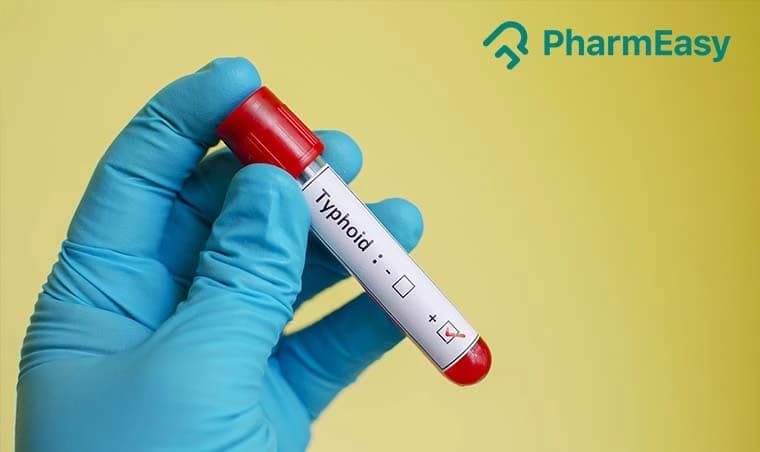 Typhoid Test: Types, When to Get Tested & Side Effects