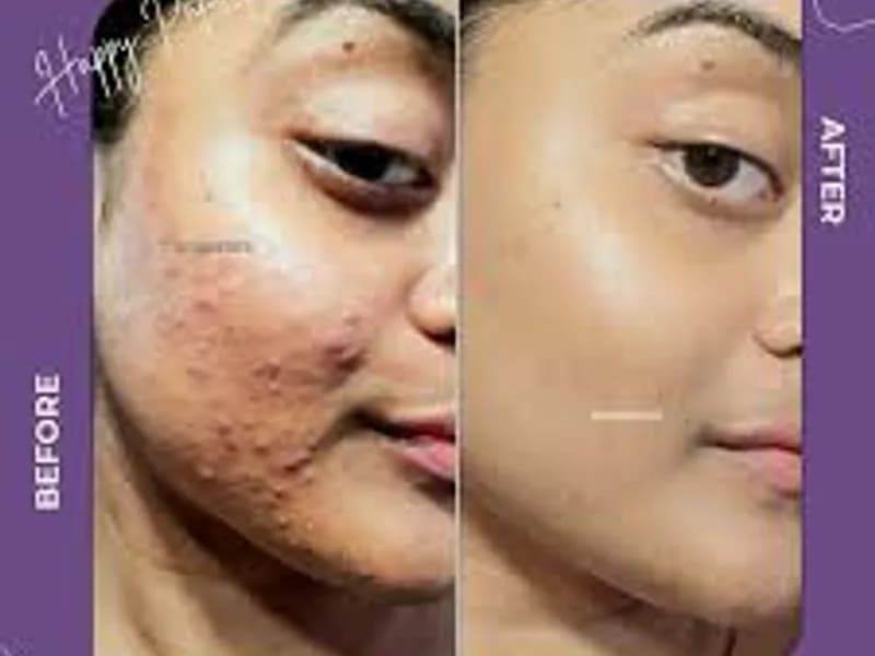 best skin care clinic in Kolkata