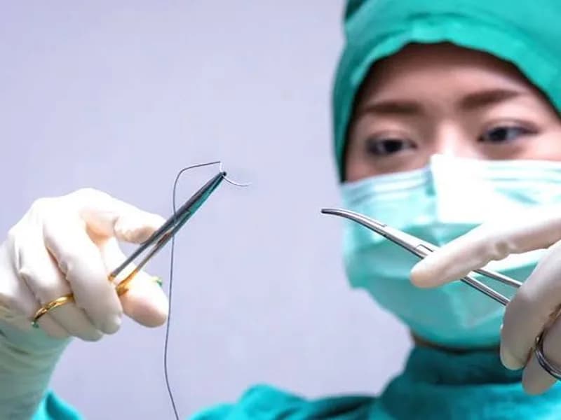 Female Suturing Stitches in Dhanbad