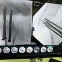 Mahavir Orthopaedic & Gerneral Hospital