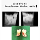 Simply Braces