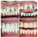 Smile Stone Dental Clinic