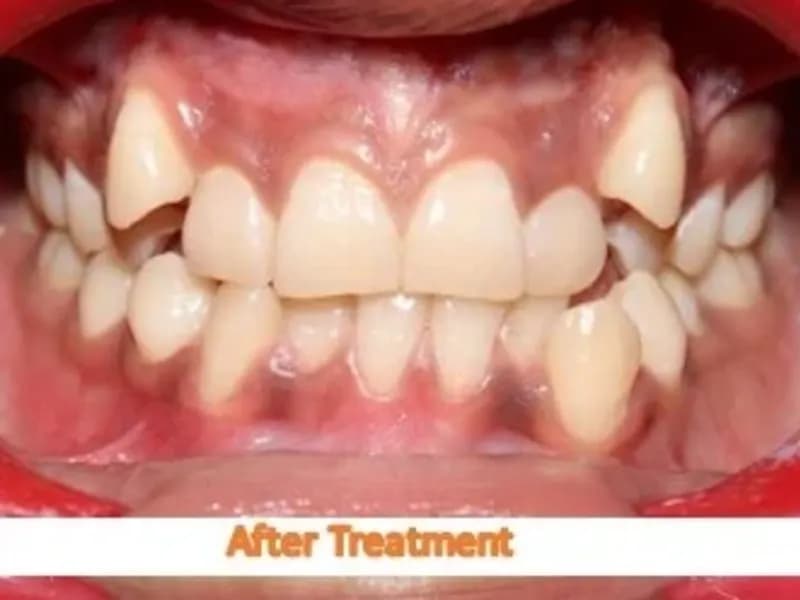 Best Dental Clinics in Deoghar: Your Guide to a Perfect Smile