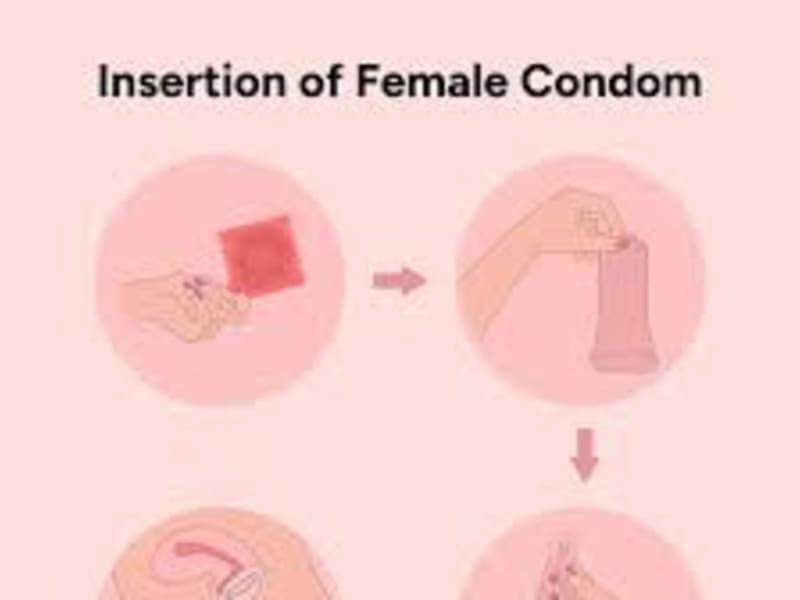 Female Condom: Uses, Benefits & How It Works